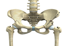 Periacetabular Osteotomy