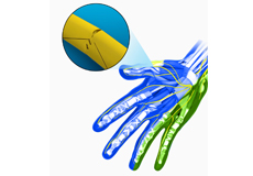 Peripheral Nerve Repair